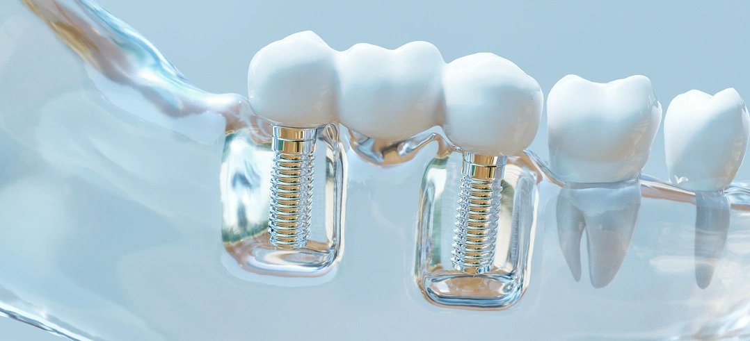 Pro Smile Dental Care