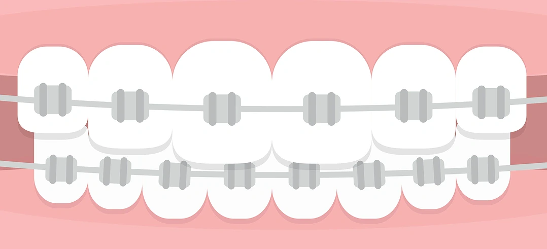Pro Smile Dental Care