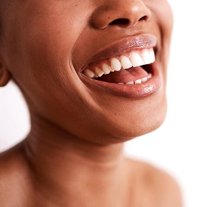 Porcelain Veneer Dentist