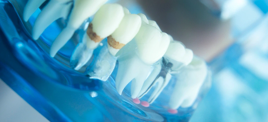 Pro Smile Dental Care