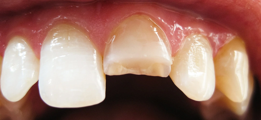 Pro Smile Dental Care