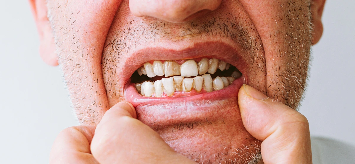 Pro Smile Dental Care