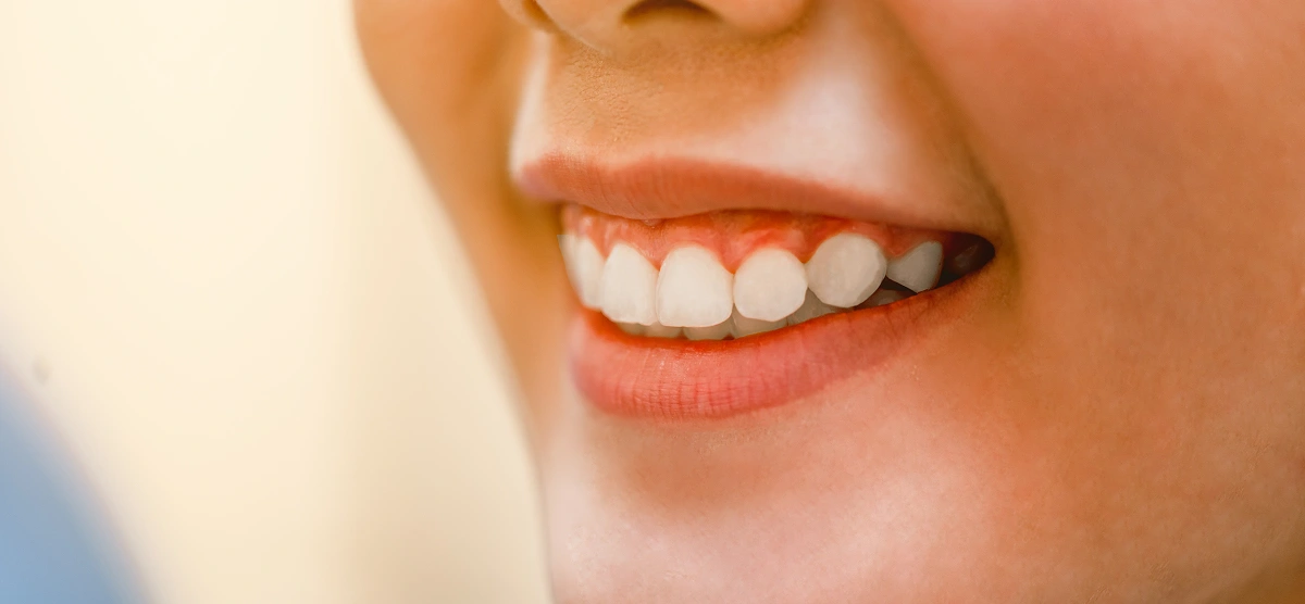 Pro Smile Dental Care