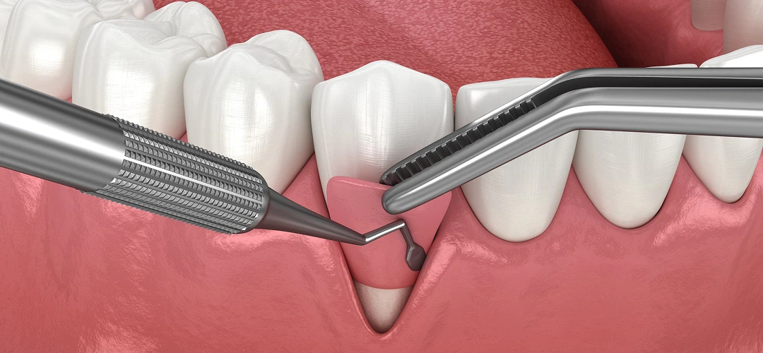 Pro Smile Dental Care