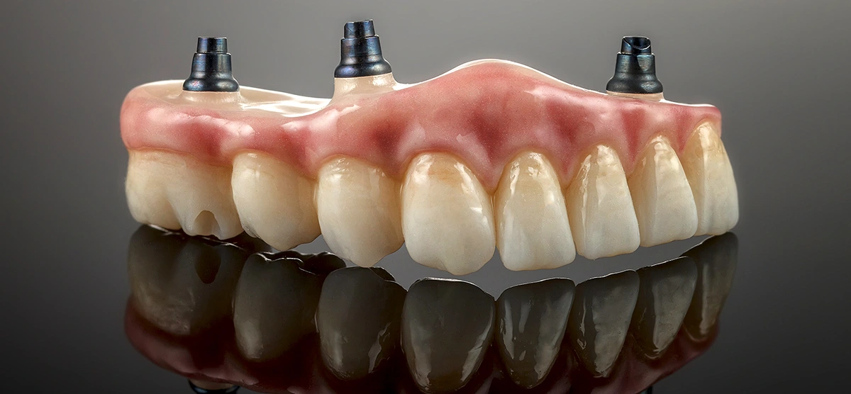 Pro Smile Dental Care
