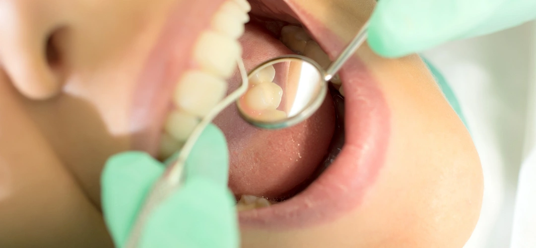 Pro Smile Dental Care