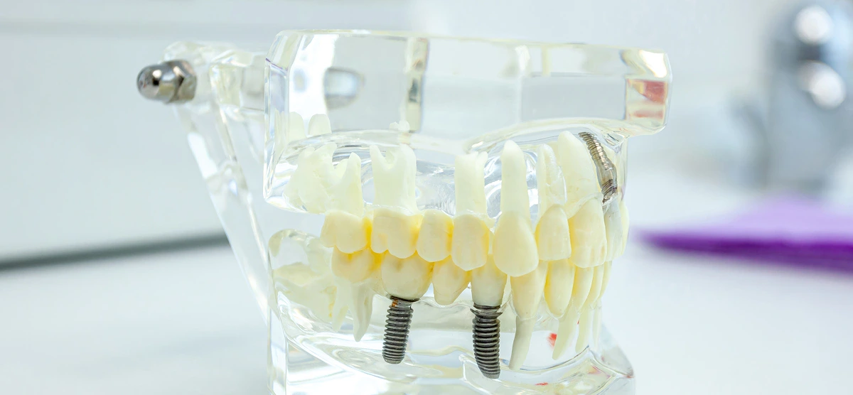 Pro Smile Dental Care